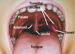 tonsilsadenoid-mouth